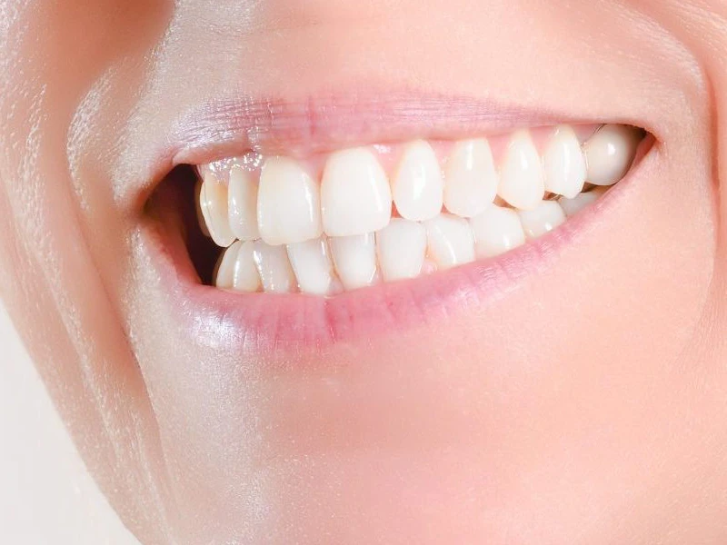 Close-up of a smiling mouth