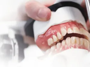 Model of teeth and gums